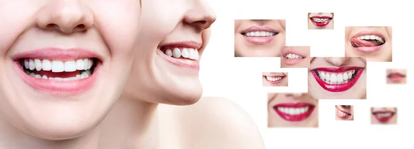 Collage of young woman near collage with health teeth. — Stock Photo, Image