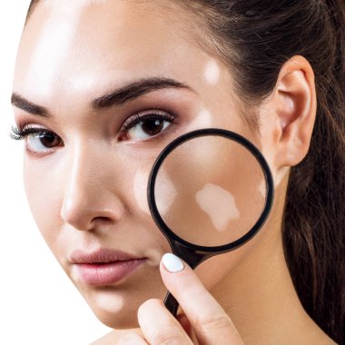 Vitiligo ile güzel kadın Büyüteç tutar.