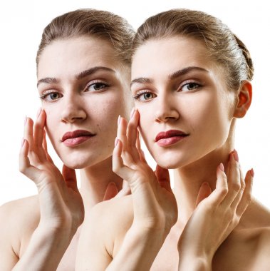 Genç şehvetli kadın önce ve sonra cilt tedavisi.