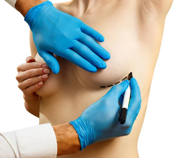 Cirugía plástica para corrección mamaria femenina . — Foto de Stock