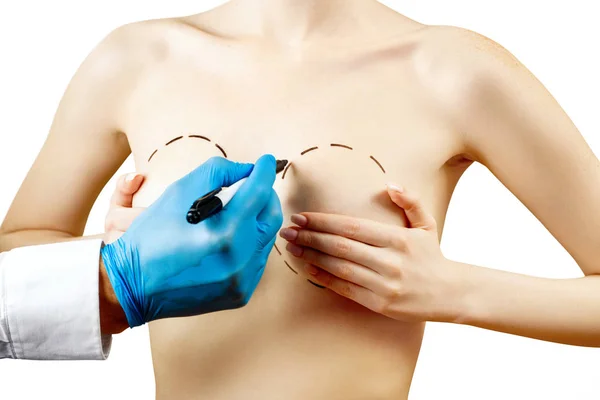 Plastik kirurgi för kvinnlig bröst korrigering. — Stockfoto