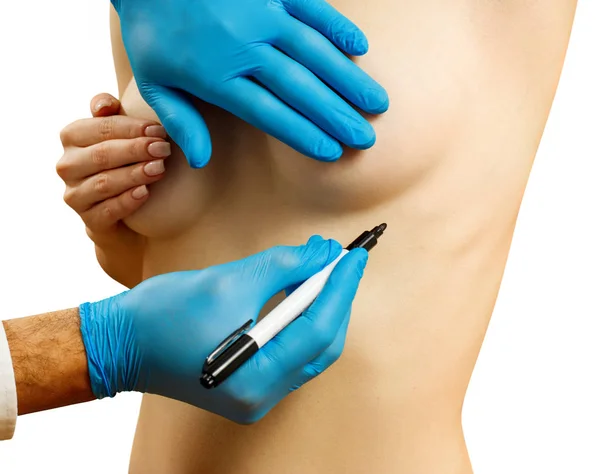 Plastische chirurgie voor vrouwelijke borstcorrectie. — Stockfoto