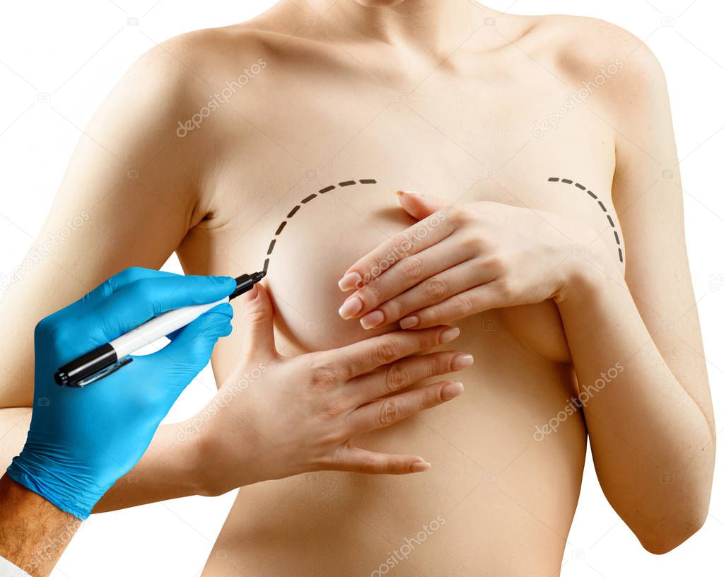 Plastic surgery for female breast correction.