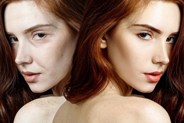 Mujer joven antes y después del rejuvenecimiento . —  Fotos de Stock