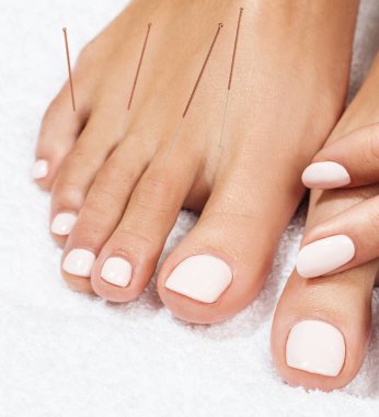 Eklemek akupunktur iğneler ile kadın bacaklar.