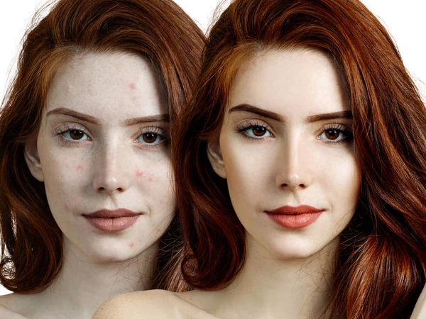 Mulher jovem antes e depois do tratamento da pele e maquiagem . — Fotografia de Stock
