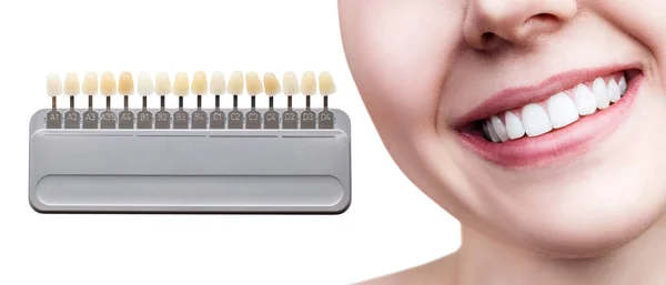Collage de la palette dentaire avec blanchiment des dents féminines . — Photo