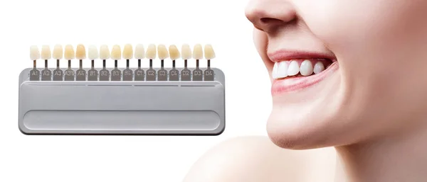 Collage di tavolozza dei denti con sbiancamento dei denti femminili . — Foto Stock