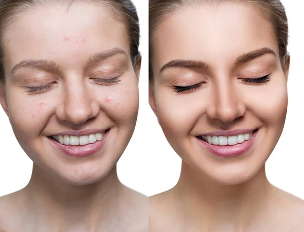 Jeune femme avant et après le traitement de la peau et le maquillage . — Photo