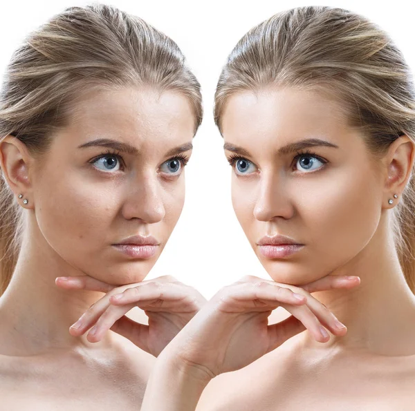 Comparison portrait of young woman before and after retouch. — Stock Photo, Image