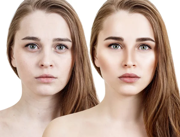 Comparison portrait of young woman before and after retouch. — Stock Photo, Image