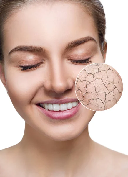 Zoom circle shows dry facial skin before moistening. — Stock Photo, Image
