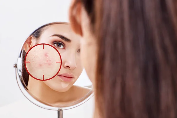 Giovane donna con pelle di acne in rosso obiettivo . Fotografia Stock