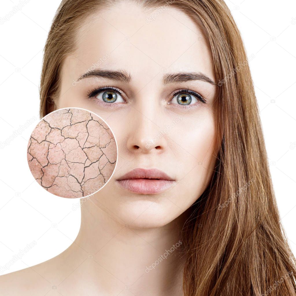 Zoom circle shows dry facial skin before moistening.