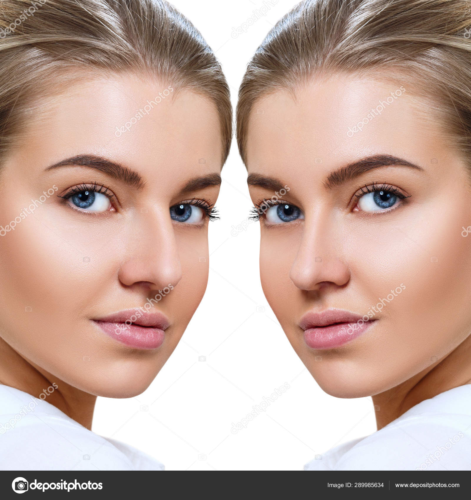 Female nose before and after cosmetic surgery. ⬇ Stock Photo, Image by