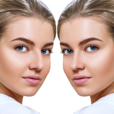 Female nose before and after cosmetic surgery. clipart