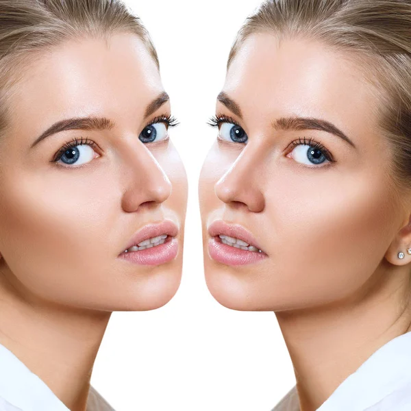 Nariz feminino antes e depois da cirurgia estética . — Fotografia de Stock