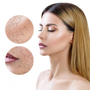 Daire gösterir kuru yüz cilt nemlendirme önce zoom.