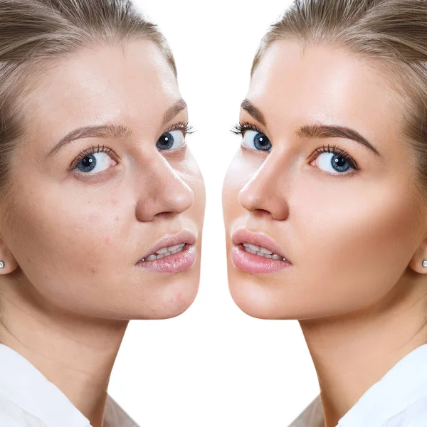 Jonge vrouw voor en na de huid behandeling en make-up. — Stockfoto