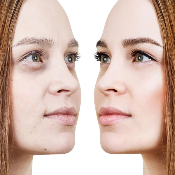 Νεαρή γυναίκα πριν και μετά το μακιγιάζ στο πρόσωπο. — Φωτογραφία Αρχείου
