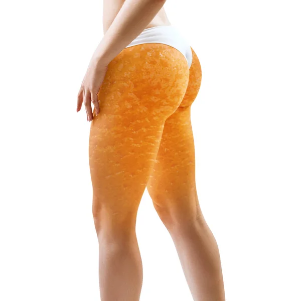 Pantat wanita dengan tekstur kulit oranye . — Stok Foto