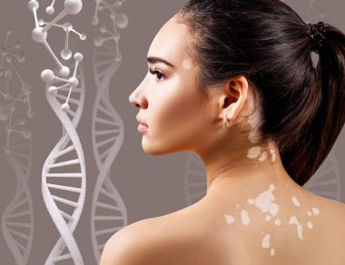Dna zincirleri vitiligo ile genç şehvetli kadın.