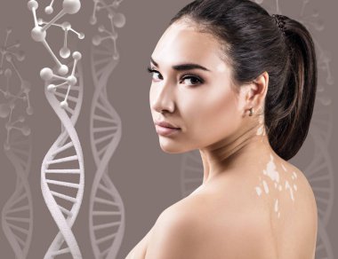 Dna zincirleri vitiligo ile genç şehvetli kadın.