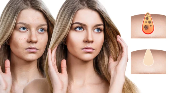 Güzel kadın kirletecek ve yüz gözenekleri temizlemek nasıl gösterir.