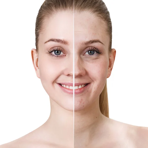 Young woman before and after treatment and make-up. Stock Photo
