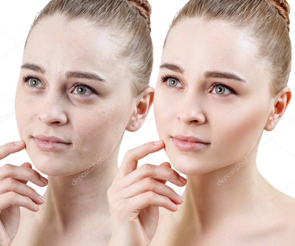 Comparison portrait of young woman before and after retouch