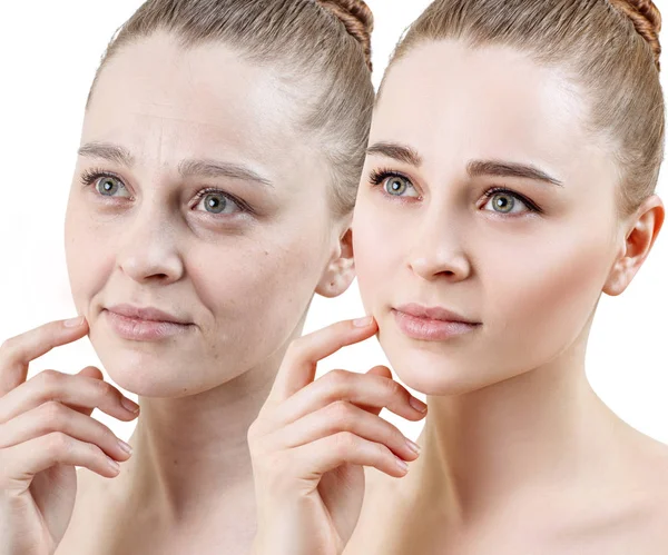 Portrait of woman before and after skin rejuvenation. — Stock Photo, Image