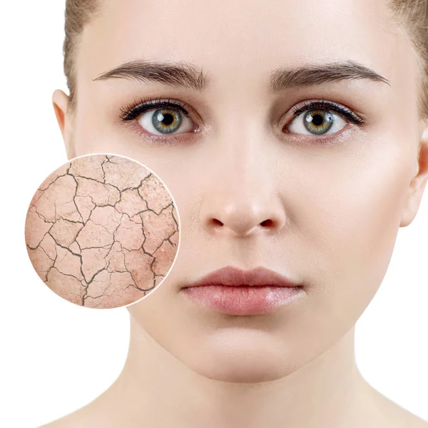 Zoom circle shows dry facial skin before moistening. — Stock Photo, Image