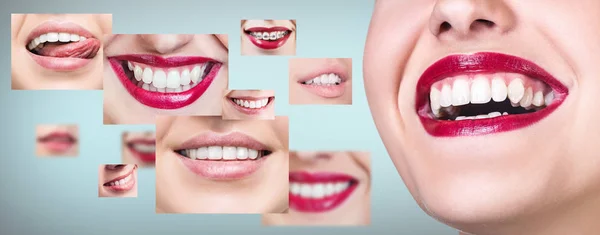 Mulher jovem perto de colagem com dentes de saúde . — Fotografia de Stock