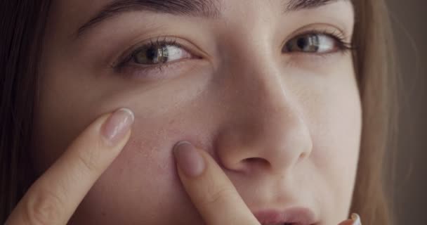 Beautiful young girl touches pimple on face by hands. — Stock Video