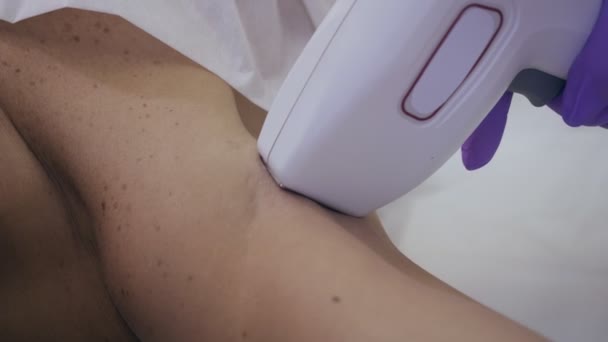 Frau bekommt Laser-Haarentfernung im Schönheitssalon. — Stockvideo