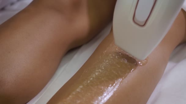 Vista ravvicinata sulle gambe femminili ottenere procedura di depilazione laser . — Video Stock