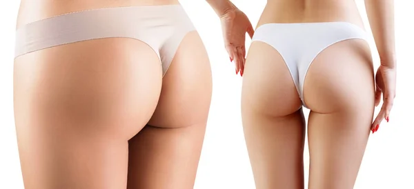 从不同角度来看完美女性臀部的结合部. — 图库照片