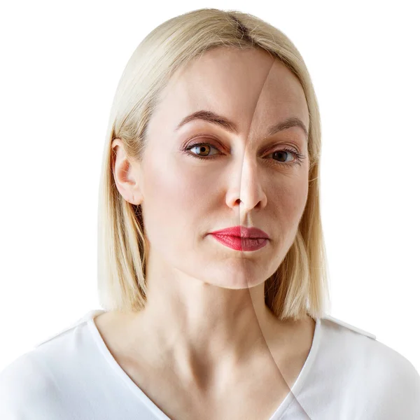 Vrouw met acne voor en na de behandeling en make-up. — Stockfoto