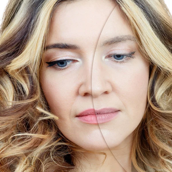 Mujer con acné antes y después del tratamiento y maquillaje . —  Fotos de Stock