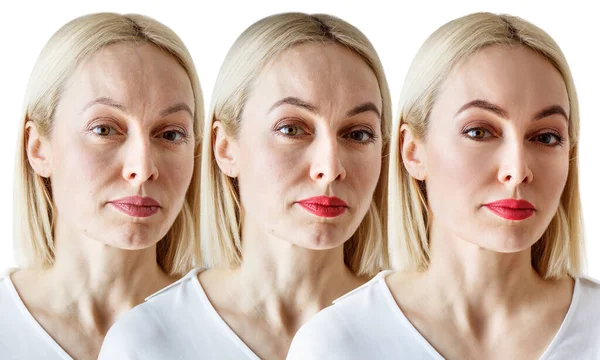 Tres retratos de cerca de una mujer, comparación antes y después — Foto de Stock