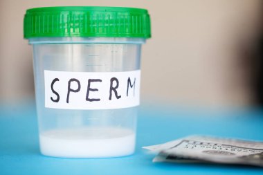Sağlık. Donör Sperm. Kavram banka Sperm kadar kapatın. Kısırlık banka Sperm ve para ile. Mavi zemin üzerine sperm analizi.
