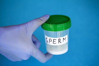 Sağlık. Sperm analizi. Banka Sperm kavramı. Kısırlık. İçin kapsayıcı tutan doktor el analiz eder.