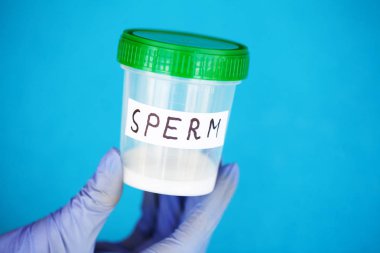 Sağlık. Sperm analizi. Banka Sperm kavramı. Kısırlık. İçin kapsayıcı tutan doktor el analiz eder.