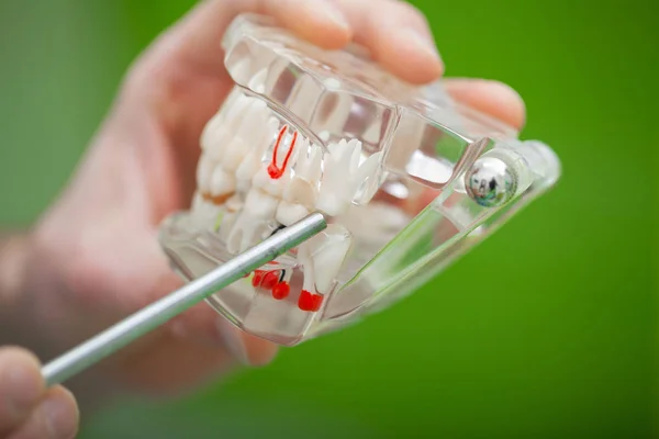 Dentista sostén de la mano del modelo de mandíbula de los dientes y limpieza dental con herramienta dental — Foto de Stock