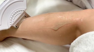 Cilt bakımı. Kozmetolojist bacaklarda lazer epilasyon yapar