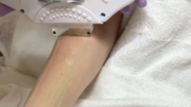 Cilt bakımı. Kozmetolojist bacaklarda lazer epilasyon yapar