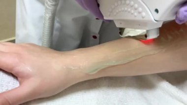 Cilt bakımı. Kozmetolojist bacaklarda lazer epilasyon yapar