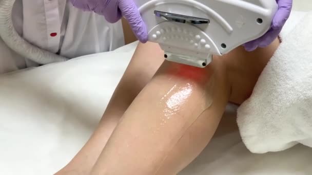 Soins de la peau. Cosmetologue fait épilation laser sur les jambes — Video