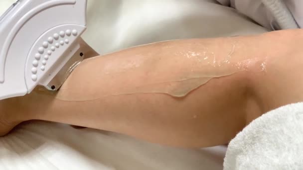 Cuidado de la piel. Cosmetólogo hace depilación láser en las piernas — Vídeo de stock
