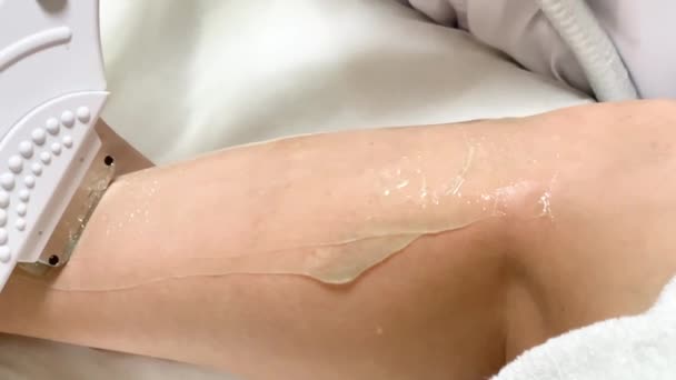 Soins de la peau. Cosmetologue fait épilation laser sur les jambes — Video